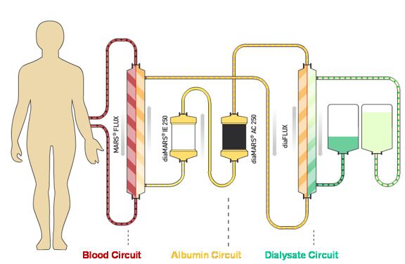 Albumin dialysis circuit