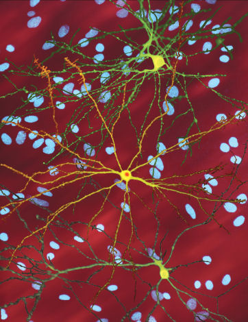 File:Neuron with mHtt inclusion.jpg