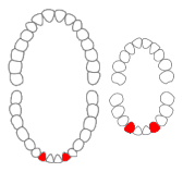 Mandibular lateral incisors01-01-06.png