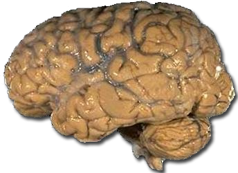 File:Human brain NIH.png