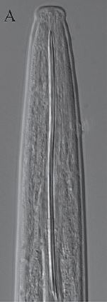 Xiphinema parasimile female anterior.jpg