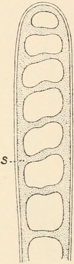 "Climacosphenia moniligera", section of upper portion of cell to show the perforated septum (s). By George Stephen West after Otto Friedrich Müller.