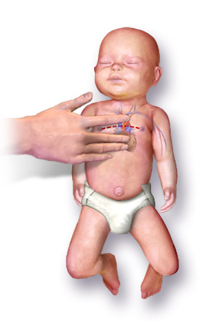 CPR Infant.png