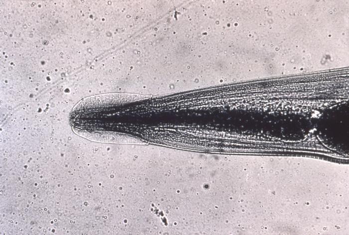 File:Head of Enterobius vermicularis human pinworm 5230 lores.jpg
