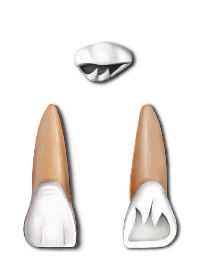 File:Maxillary central incisor.jpg