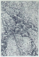 Helicobacter pylori2.jpg