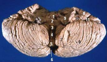 File:Human cerebellum anterior view description.JPG