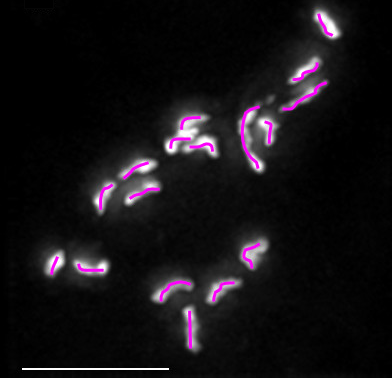 File:Chromosomal spreads of single itch mite (Sarcoptes scabiei) cell - 17 chromosomes.png