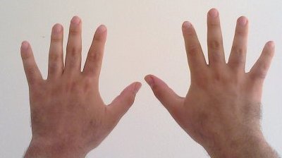 File:Two hand, ten fingers.jpg