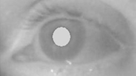File:Bright pupil by infrared or near infrared illumination.jpg