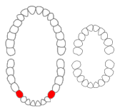 File:Mandibular first premolars01-01-06.png