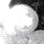 File:CMR stress perfusion inf defect.gif