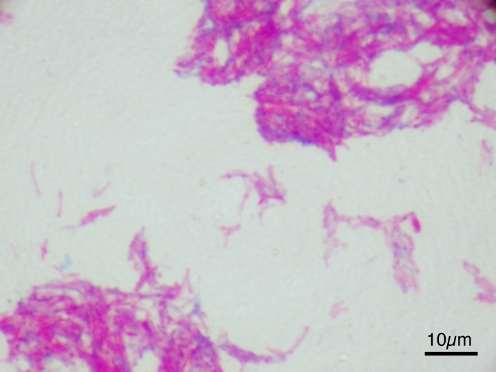 File:Mycobacterium bovis BCG ZN.jpg