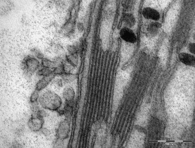 File:Chloroplast in leaf of Anemone sp TEM 85000x.png