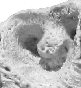File:Alveole zahn.jpg