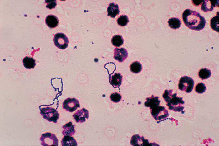 File:Streptococcus viridans PHIL 2897 lores.jpg
