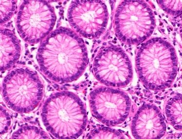 File:Micrograph of normal large intestinal crypts.jpg