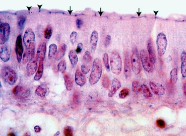 Biology:Terminal bar (histology) - HandWiki