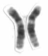 File:Human male karyotpe high resolution - Chromosome 12 cropped.png
