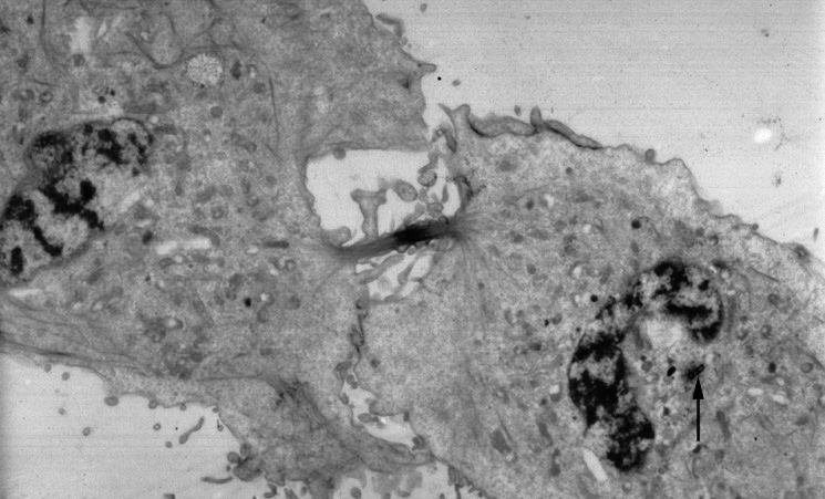 File:Cytokinesis-electron-micrograph.jpg