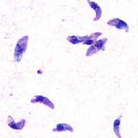 "Toxoplasma gondii" tachyzoites