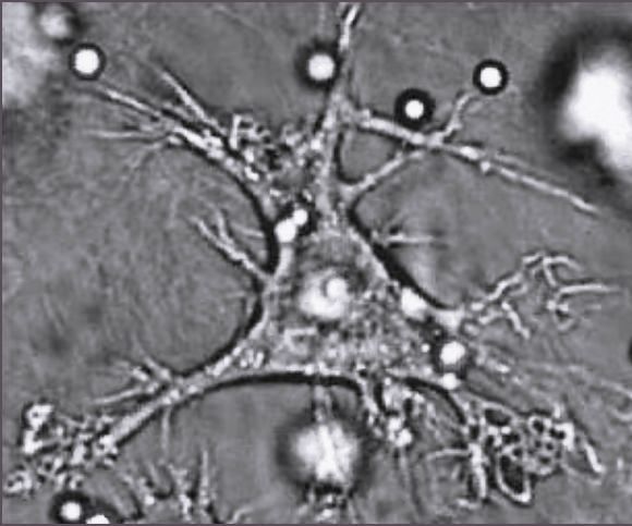 File:Dendritic cell.JPG