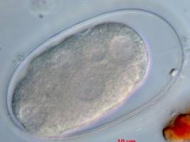 File:Parasite140080-fig3 Gastrointestinal parasites in seven primates of the Taï National Park - Helminths Figure 3e.jpg