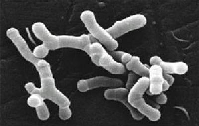 File:Bifidobacterium longum en microscopie électronique.jpg