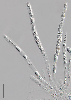 File:Hypomyces chrysospermus.jpg