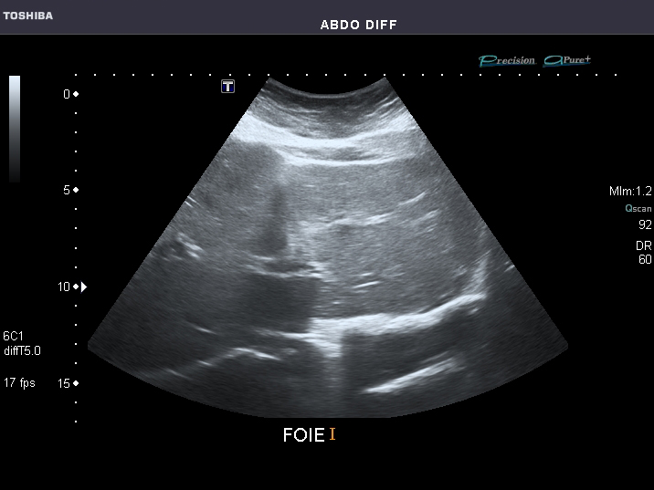 File:Abdominal Ultrasound Full Exam 08.jpg
