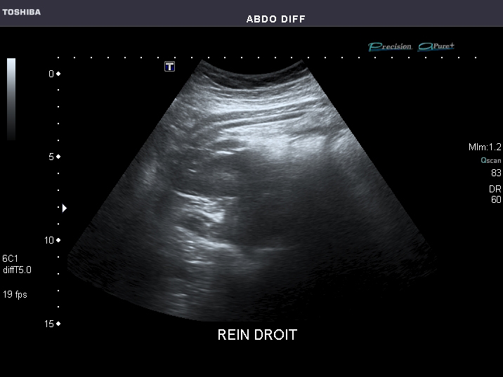 File:Abdominal Ultrasound Full Exam 31.jpg
