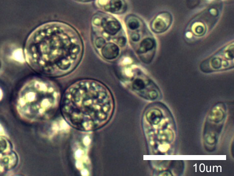 File:Amoebidium parasiticum.jpg