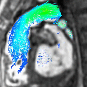 File:Cardiac MRI vector.gif