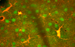 File:Astrocytes-mouse-cortex.png