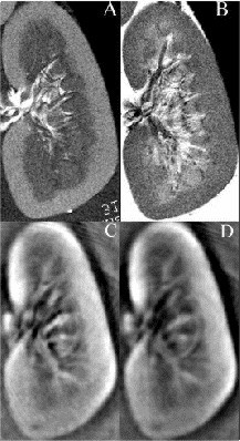 File:MRI vs TCT composite of lamb kidney.jpg