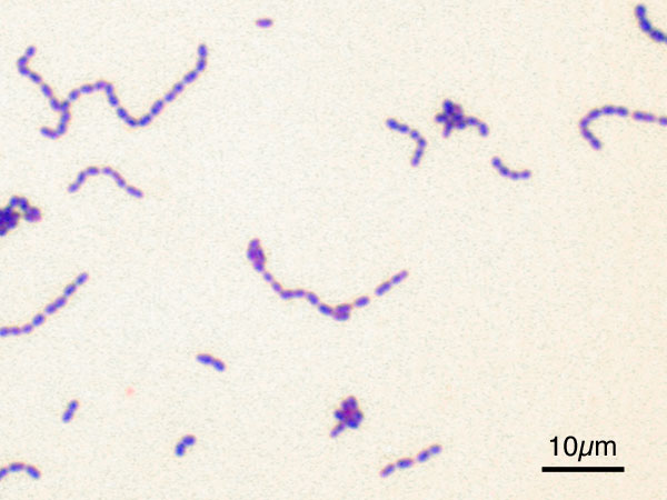 File:Streptococcus mutans Gram.jpg