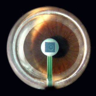 File:PASCAL SensorTip on eye.jpg