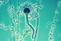 Aspergillus.jpg