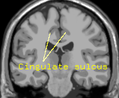 Cingulate sulcus.png
