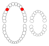 File:Maxillary first premolars01-01-06.png
