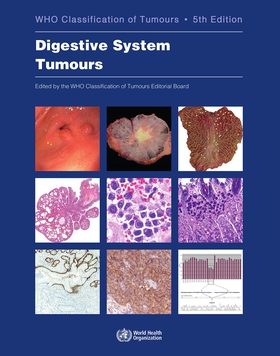 File:WHO Digestive System Tumours blue book.jpg