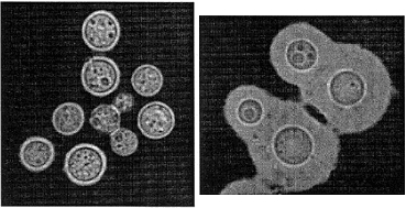 File:Cryptococcus gattii 02.jpg