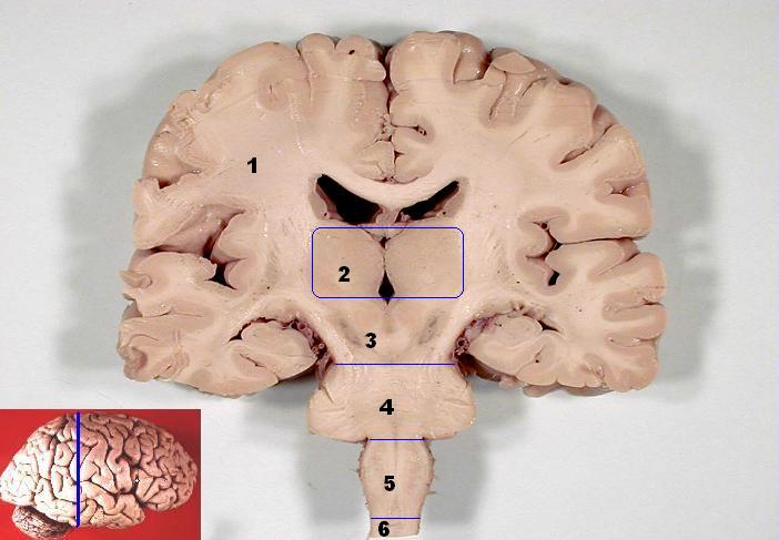 File:Human brain frontal (coronal) section description.JPG