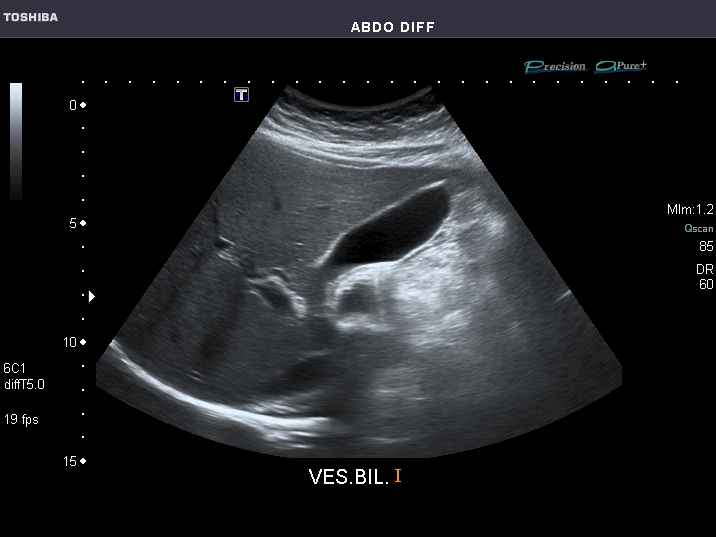 File:Abdominal Ultrasound Full Exam 10.jpg