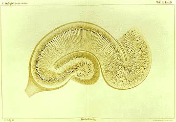 File:Golgi Hippocampus.jpg