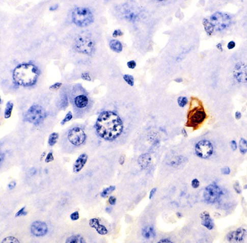 File:Apoptosis stained.jpg