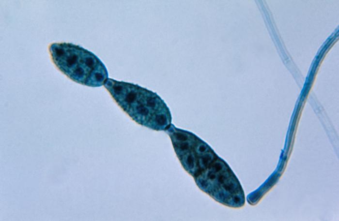File:Chain of conidia of an Alternaria sp. fungus PHIL 3963 lores.jpg