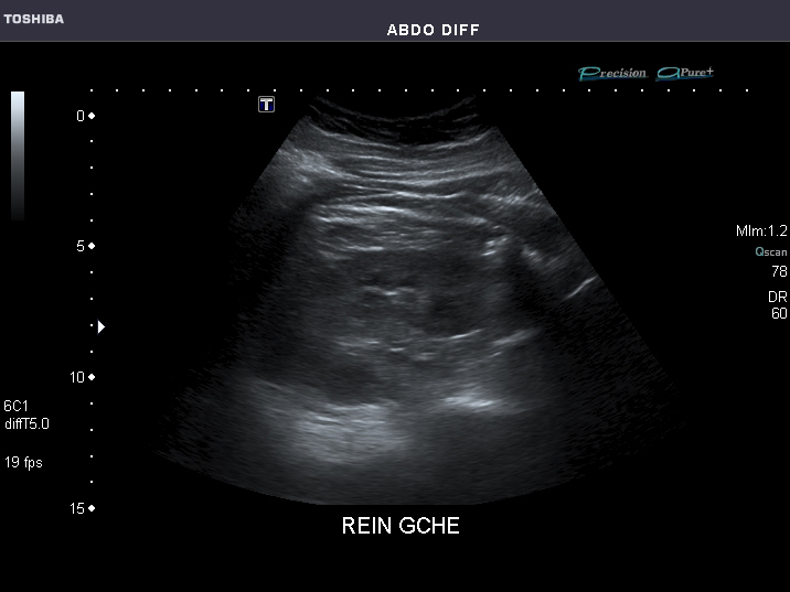 File:Abdominal Ultrasound Full Exam 50.jpg