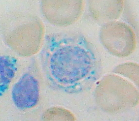 File:Sideroblast.png