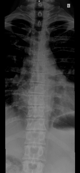 File:Spine Adult Male Age 57.png